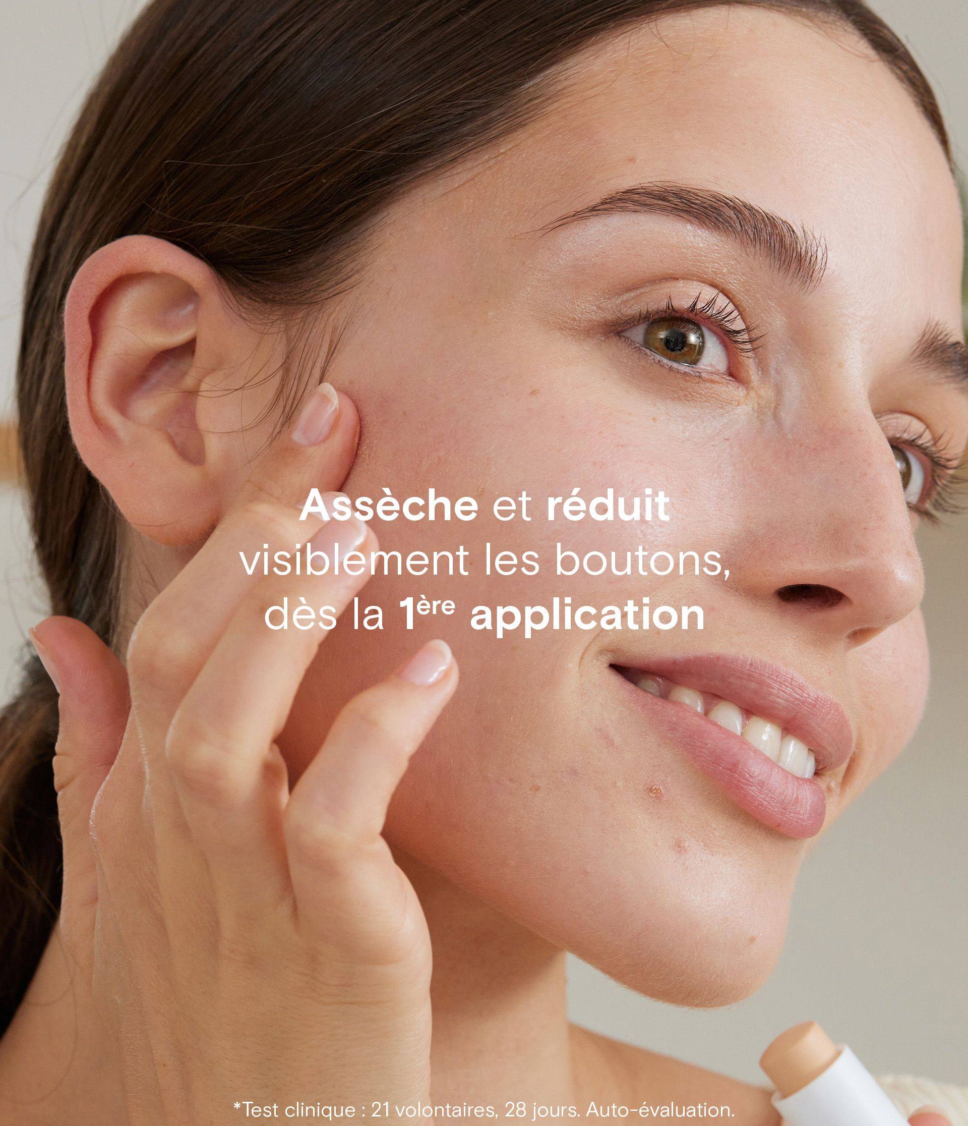 Stick correcteur claim