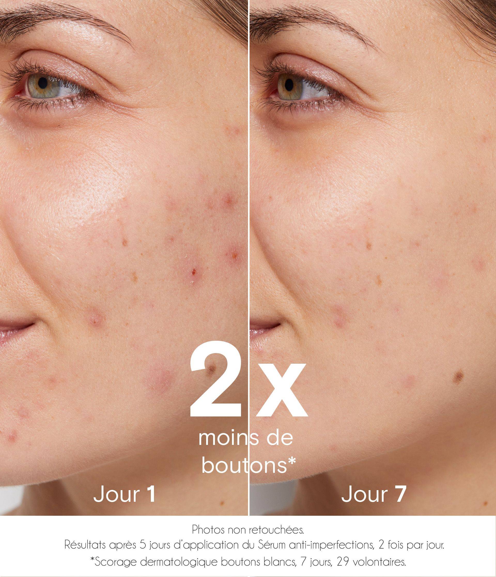 Avant / après sérum purifiant