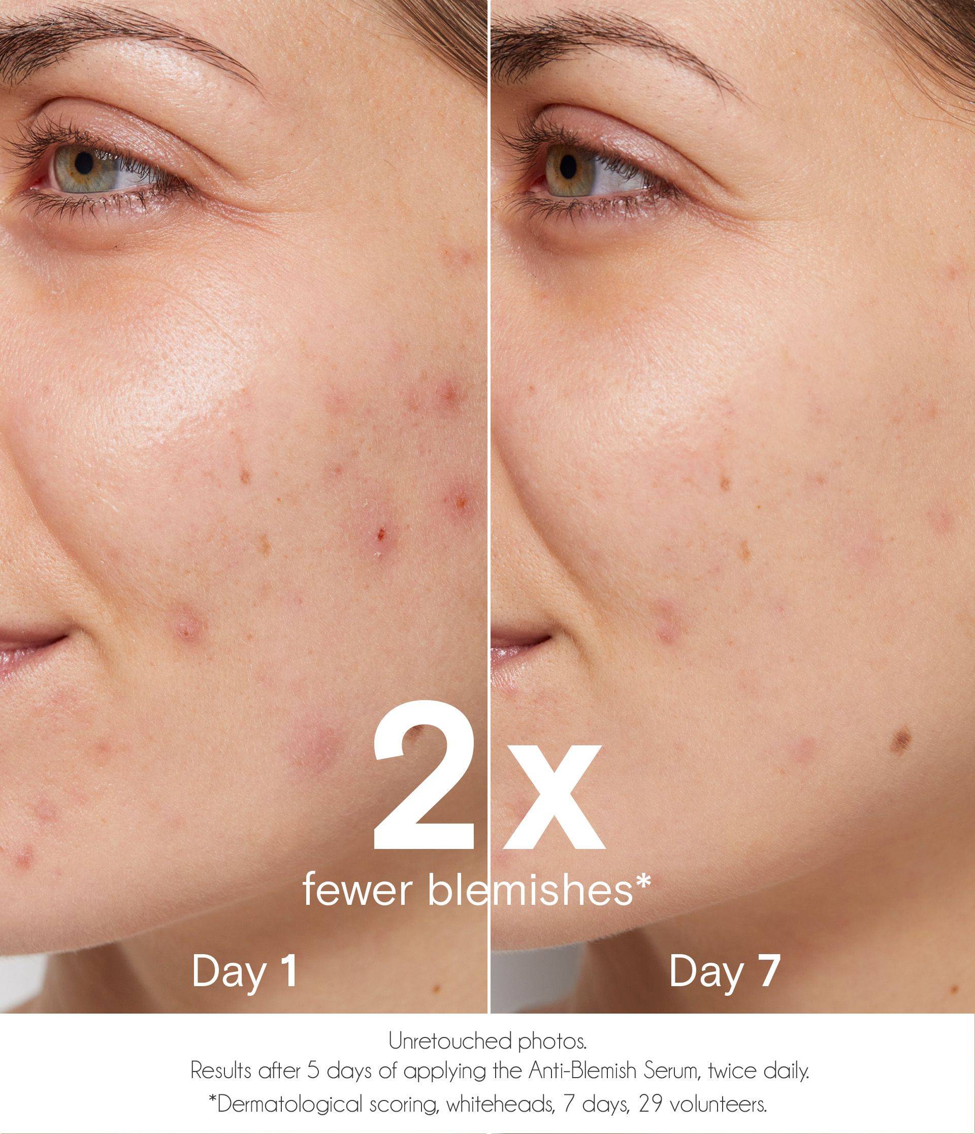 Sérum purifiant anti-imperfections - La Rosée