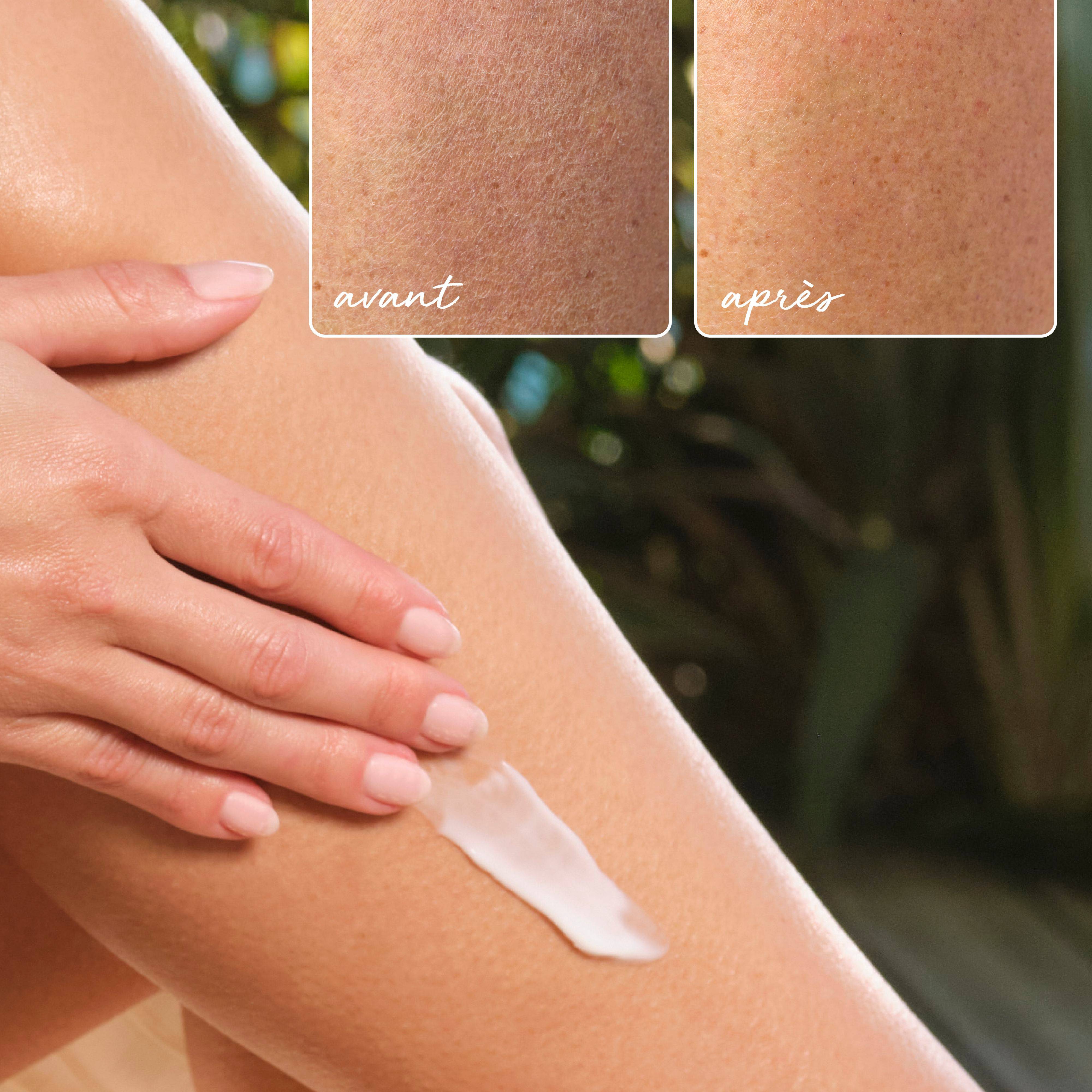 Avant/après crème corps - La Rosée